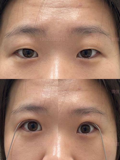 河南省直第三人民医院整形美容中 心真人口碑评价怎么样？