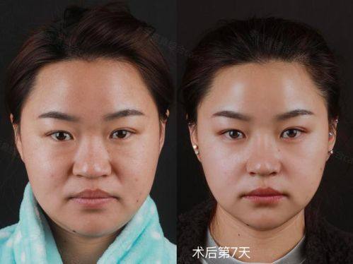 吉安佳美医疗美容门诊部收费价格表/收费标准