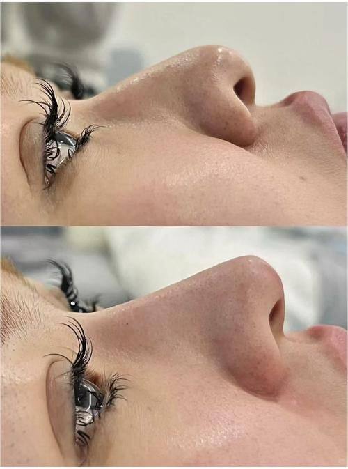 吉安佳美医疗美容门诊部真人口碑评价怎么样？