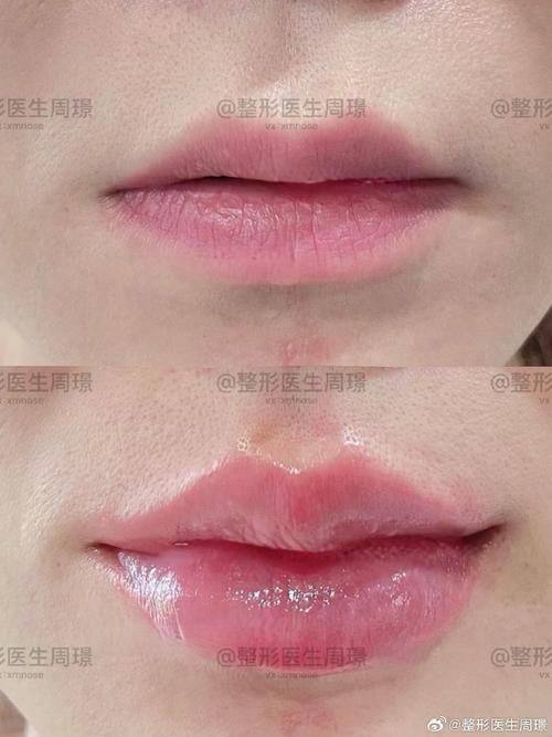 荆州柠汐美学医疗美容诊所特色项目及技术优势