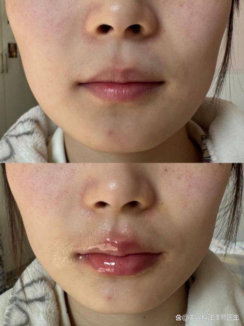 吉安佳美医疗美容门诊部特色项目及技术优势