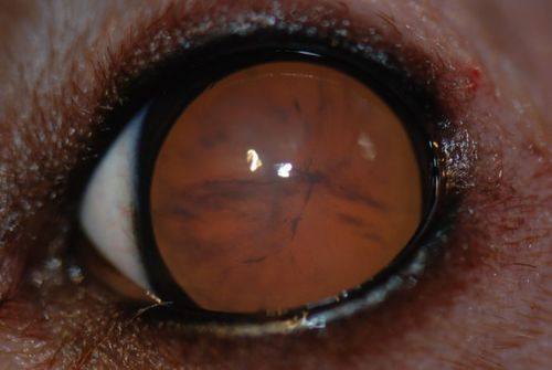 广西桂林赋盈眼科特色项目及技术优势