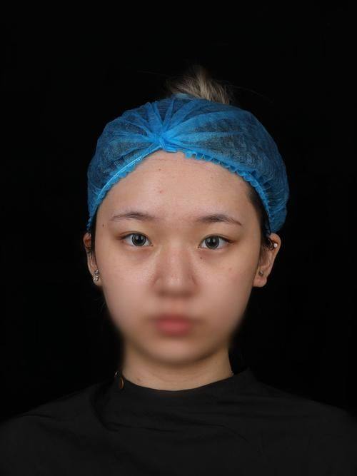 荆州柠汐美学医疗美容诊所真人口碑评价怎么样？