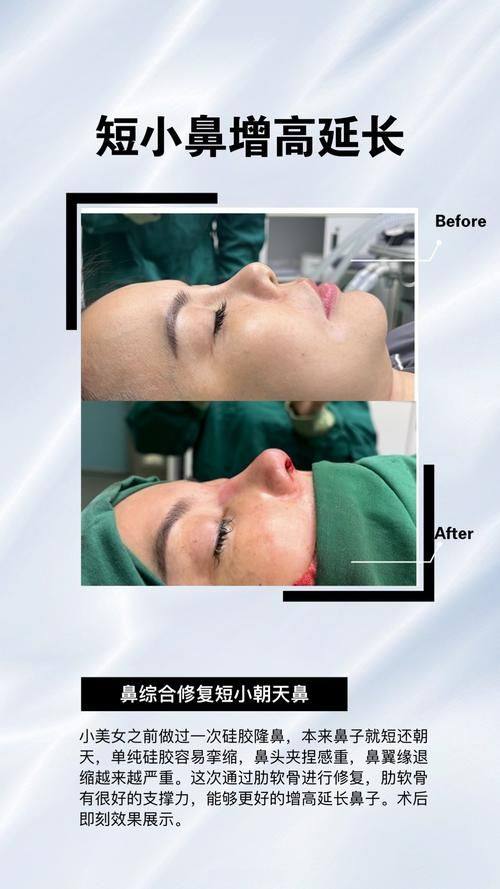 河南省直第三人民医院整形美容中 心详细的预约挂号方式及流程