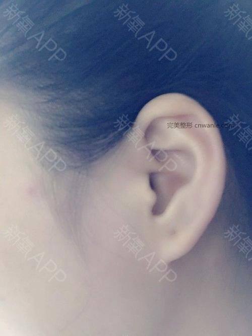 河南省直第三人民医院整形美容中 心地址电话营业时间