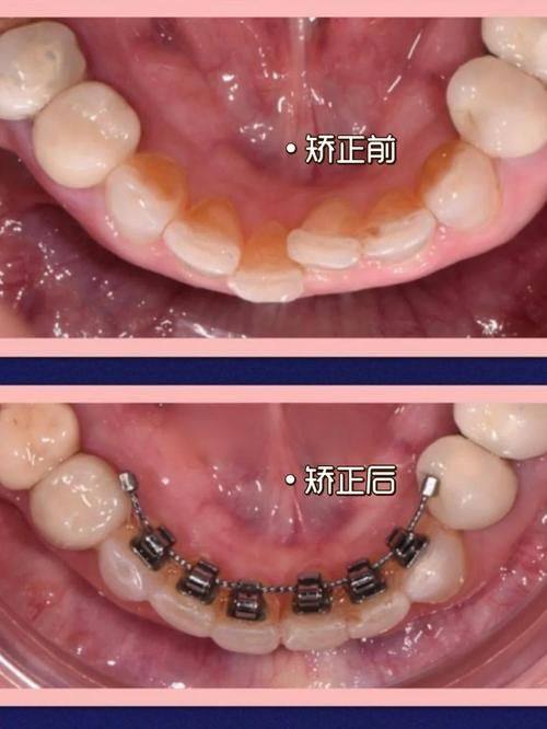 大连美尔口腔（秀月门诊）地址电话营业时间