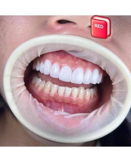 大连美尔口腔（秀月门诊）真人口碑评价怎么样？