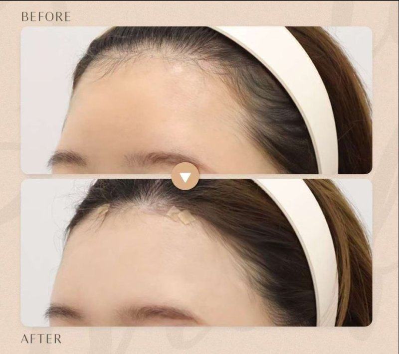 河南省直第三人民医院整形美容中 心特色项目及技术优势