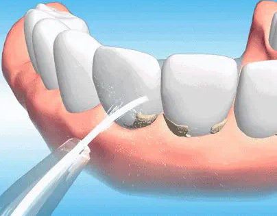 南京博韵口腔医院的口碑如何? 从真人实例看口碑