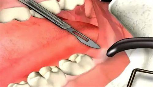 西安优德口腔地址电话营业时间