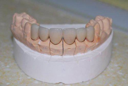 南京艾笑口腔特色项目及技术优势