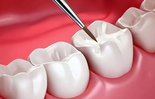 西安优德口腔详细的预约挂号方式及流程