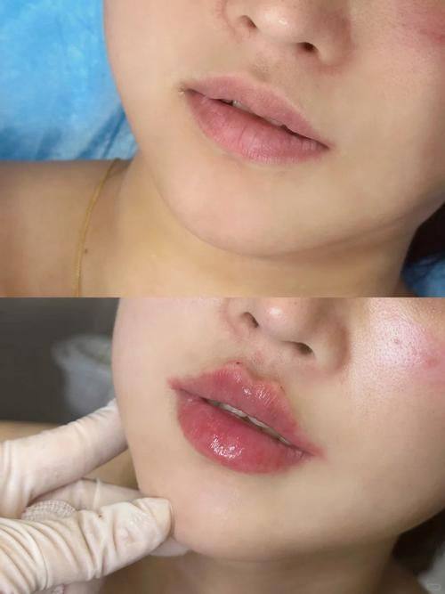 成都普拉医疗美容门诊部详细的预约挂号方式及流程