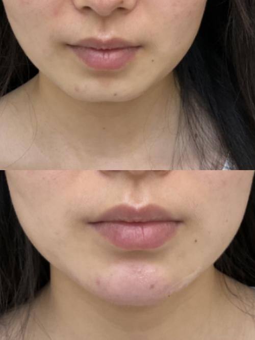 韩国RE&YOUNG皮肤科是正规医院吗？