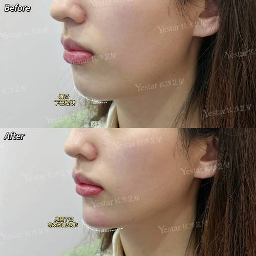 韩国RE&YOUNG皮肤科地址电话营业时间