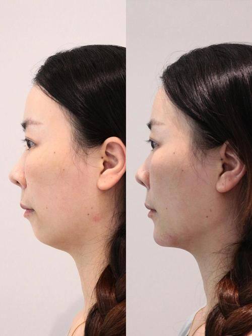 韩国RE&YOUNG皮肤科特色项目及技术优势