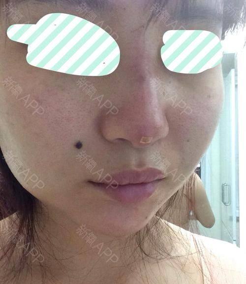 韩国RE&YOUNG皮肤科真人口碑评价怎么样？