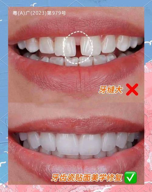 西安优德口腔收费价格表/收费标准