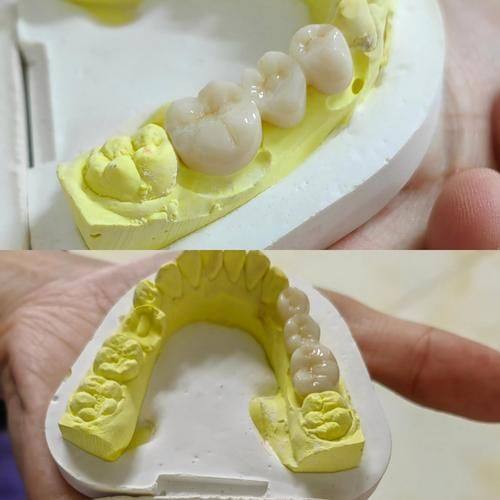 南京艾笑口腔真人口碑评价怎么样？