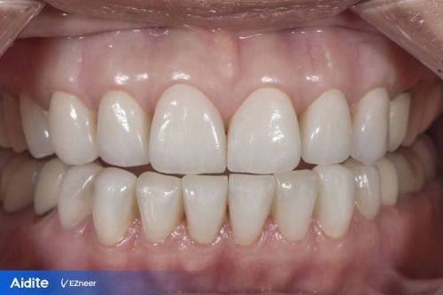 南京艾笑口腔收费价格表/收费标准