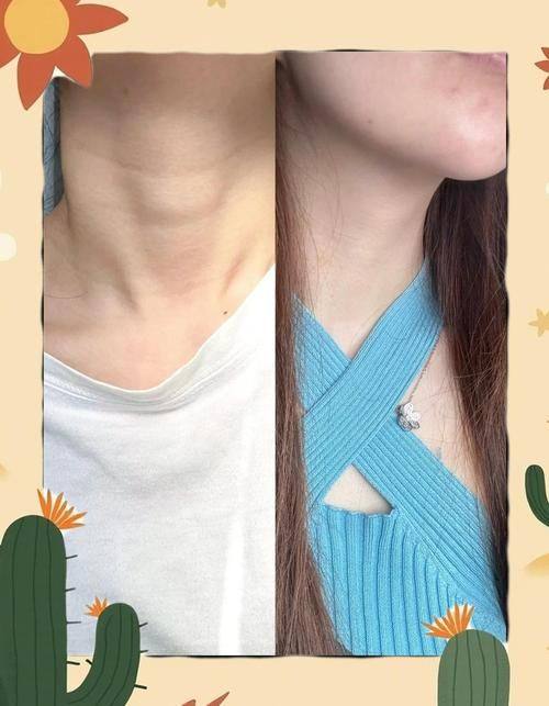 北京美易美时代医疗美容诊所真人口碑评价怎么样？