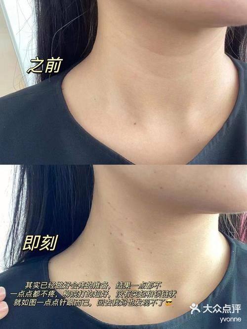 北京美易美时代医疗美容诊所收费价格表/收费标准