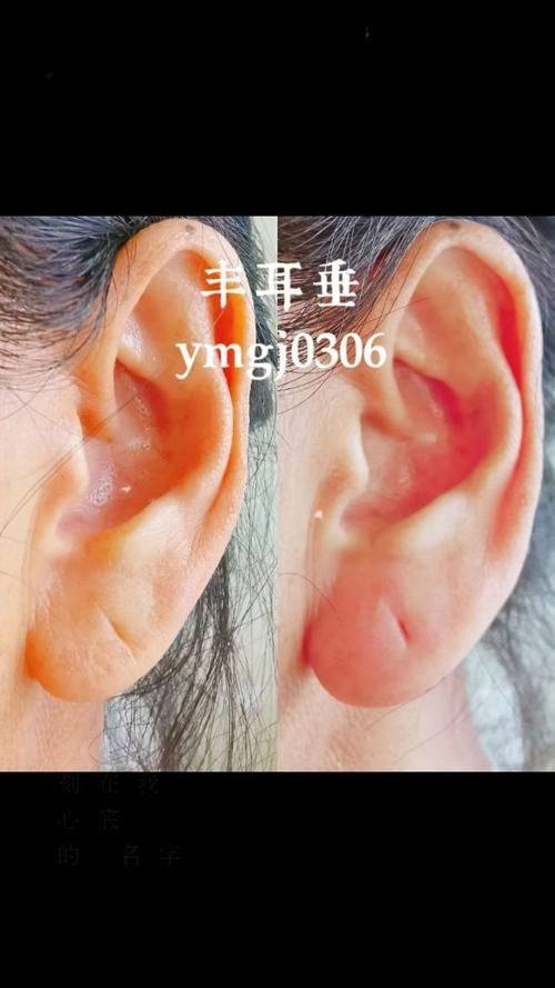 成都普拉医疗美容门诊部收费价格表/收费标准