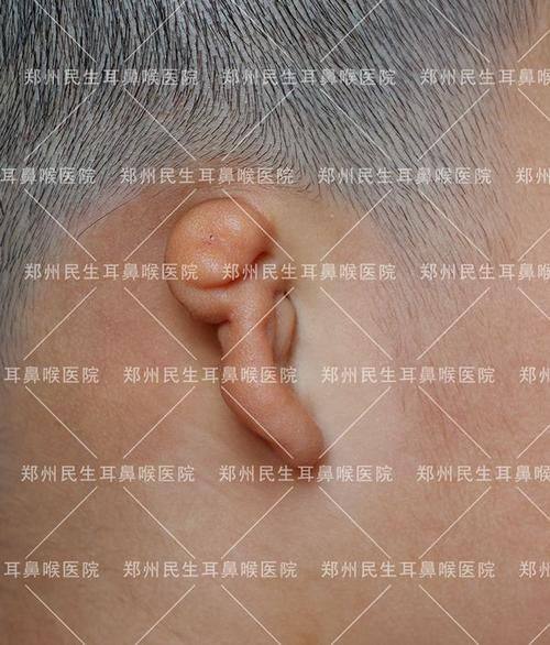 成都普拉医疗美容门诊部真人口碑评价怎么样？