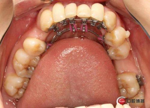 东莞铭嘉口腔门诊部真人口碑评价怎么样？