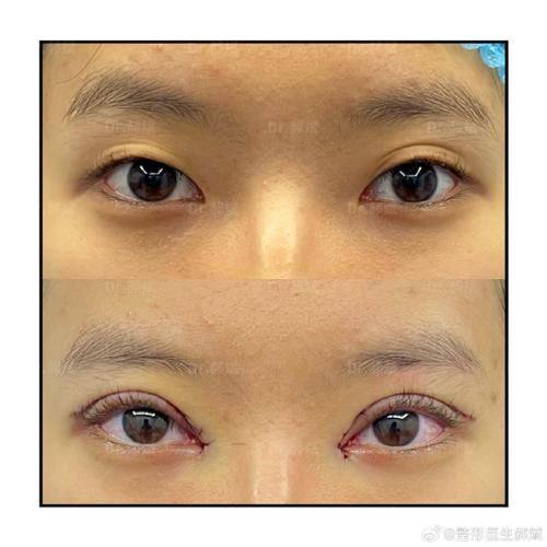 张家港第一人民医院烧伤整形科收费价格表/收费标准