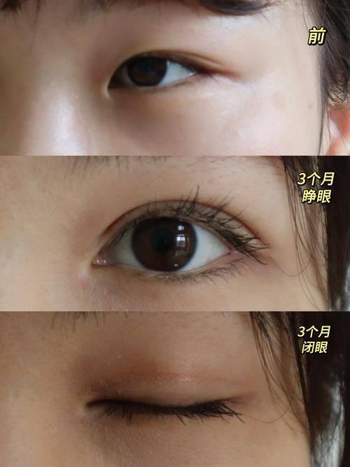 张家港第一人民医院烧伤整形科地址电话营业时间