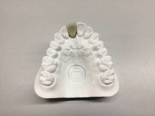 宁夏固原西吉县如齿美口腔是正规医院吗？