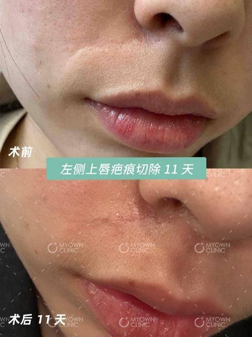 张家港第一人民医院烧伤整形科是正规医院吗？