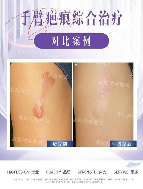 张家港第一人民医院烧伤整形科真人口碑评价怎么样？