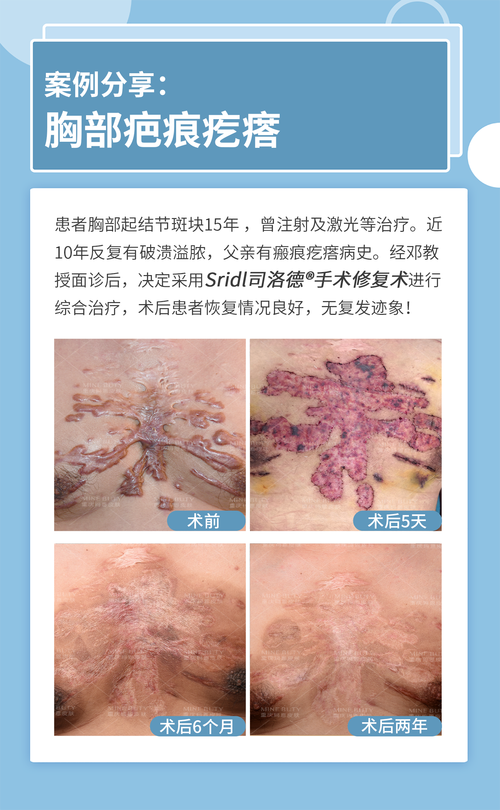 张家港第一人民医院烧伤整形科详细的预约挂号方式及流程