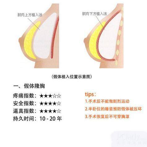 太原甜橙整形医院收费价格表/收费标准