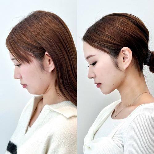 潜江蓝鸟整形医院是正规医院吗？