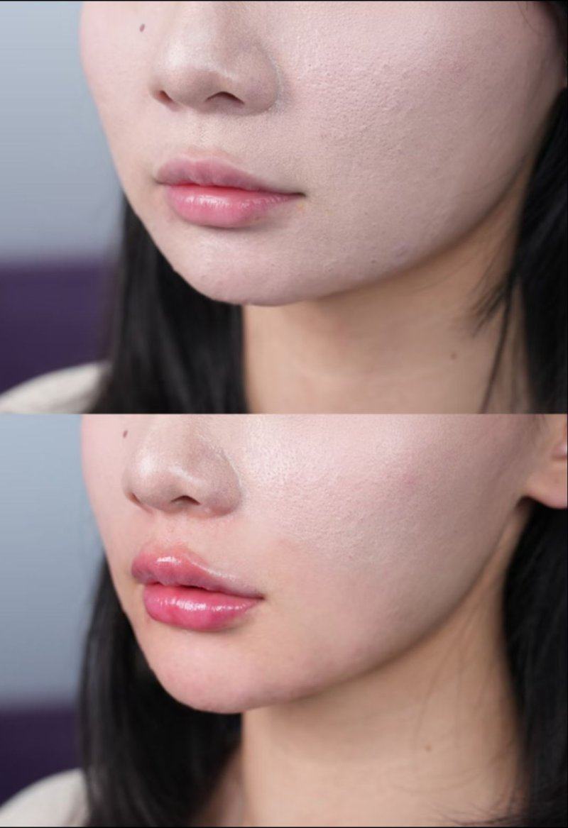 太原甜橙整形医院真人口碑评价怎么样？