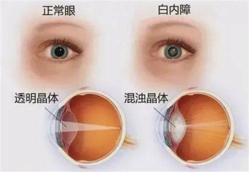 衡阳市第一人民医院眼科地址电话营业时间