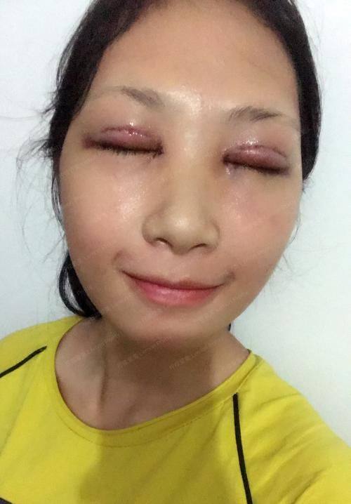 长春叁盛蓝梦医疗美容门诊部真人口碑评价怎么样？