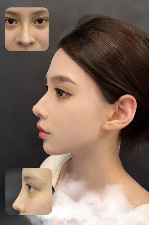 长春叁盛蓝梦医疗美容门诊部详细的预约挂号方式及流程