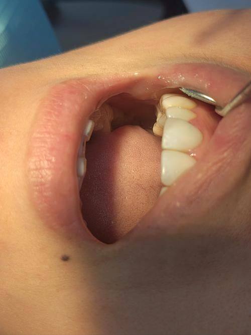 广东广州爱牙军团口腔门诊部特色项目及技术优势