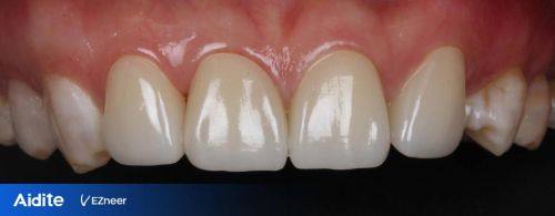 万江中合口腔门诊部真人口碑评价怎么样？