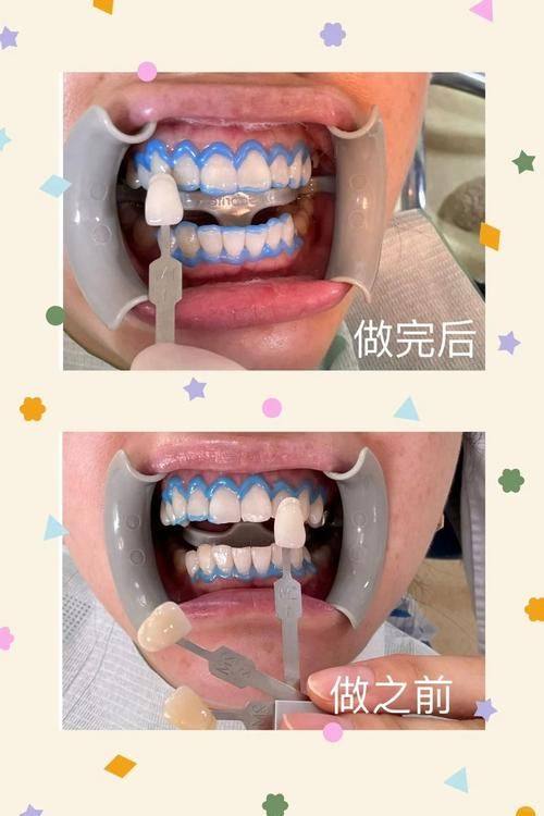 贵州贵阳富丽口腔特色项目及技术优势