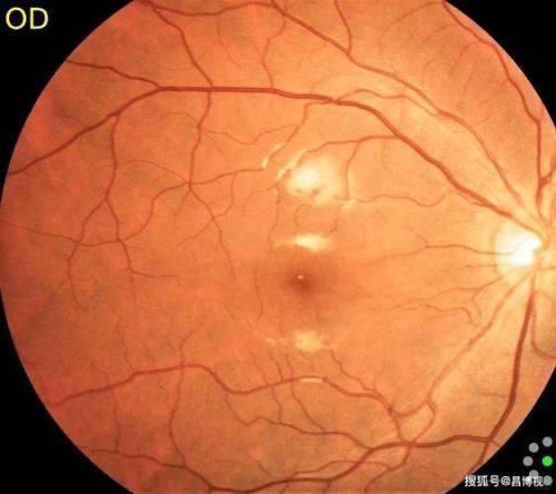 衡阳市第一人民医院眼科特色项目及技术优势