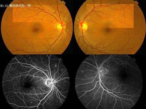 衡阳市第一人民医院眼科真人口碑评价怎么样？