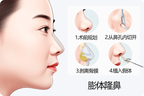 杭州师范大学附属医院整形美容科特色项目及技术优势