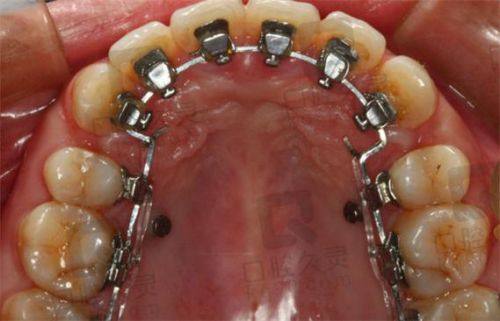 广东广州爱牙军团口腔门诊部是正规医院吗？