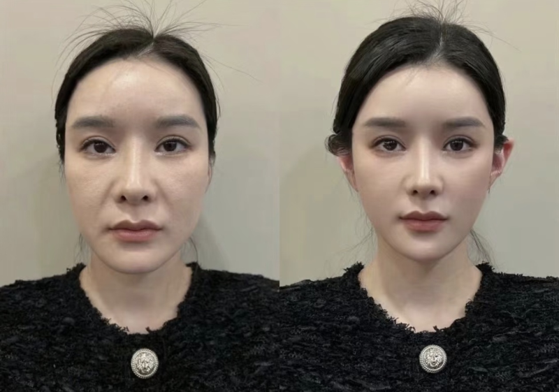 杭州师范大学附属医院整形美容科医生团队实力强大及骨干医生简介