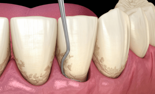 绵阳高新华美紫馨口腔门诊部详细的预约挂号方式及流程